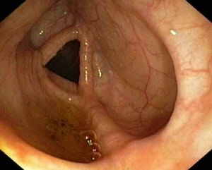 Endoscopia Digestiva Endoscopia Digestiva
